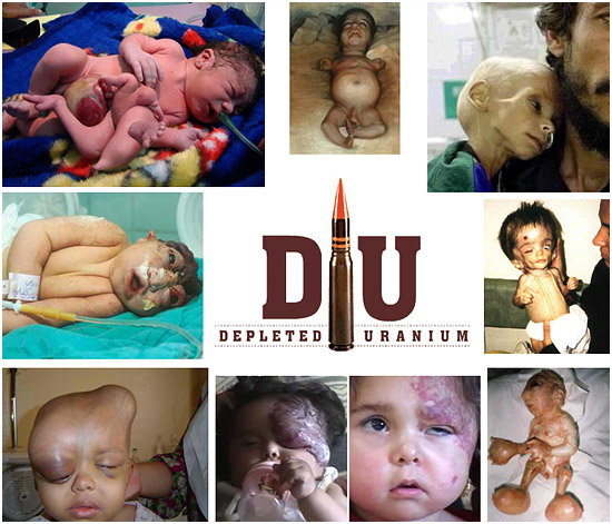 Depleated uranium and birth defects in children